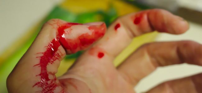 wound